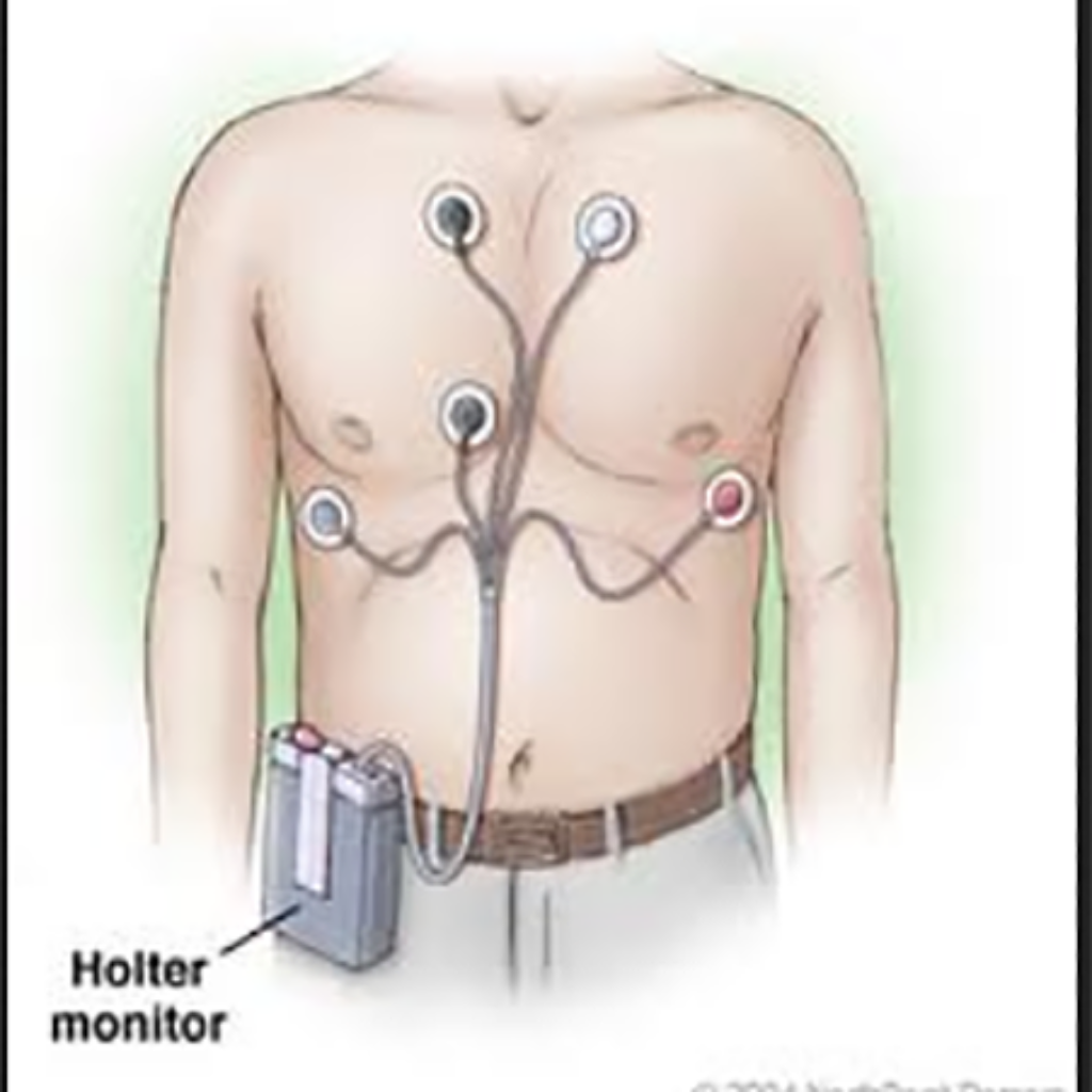 monitorizarea-holter-ecg-ambulatorie